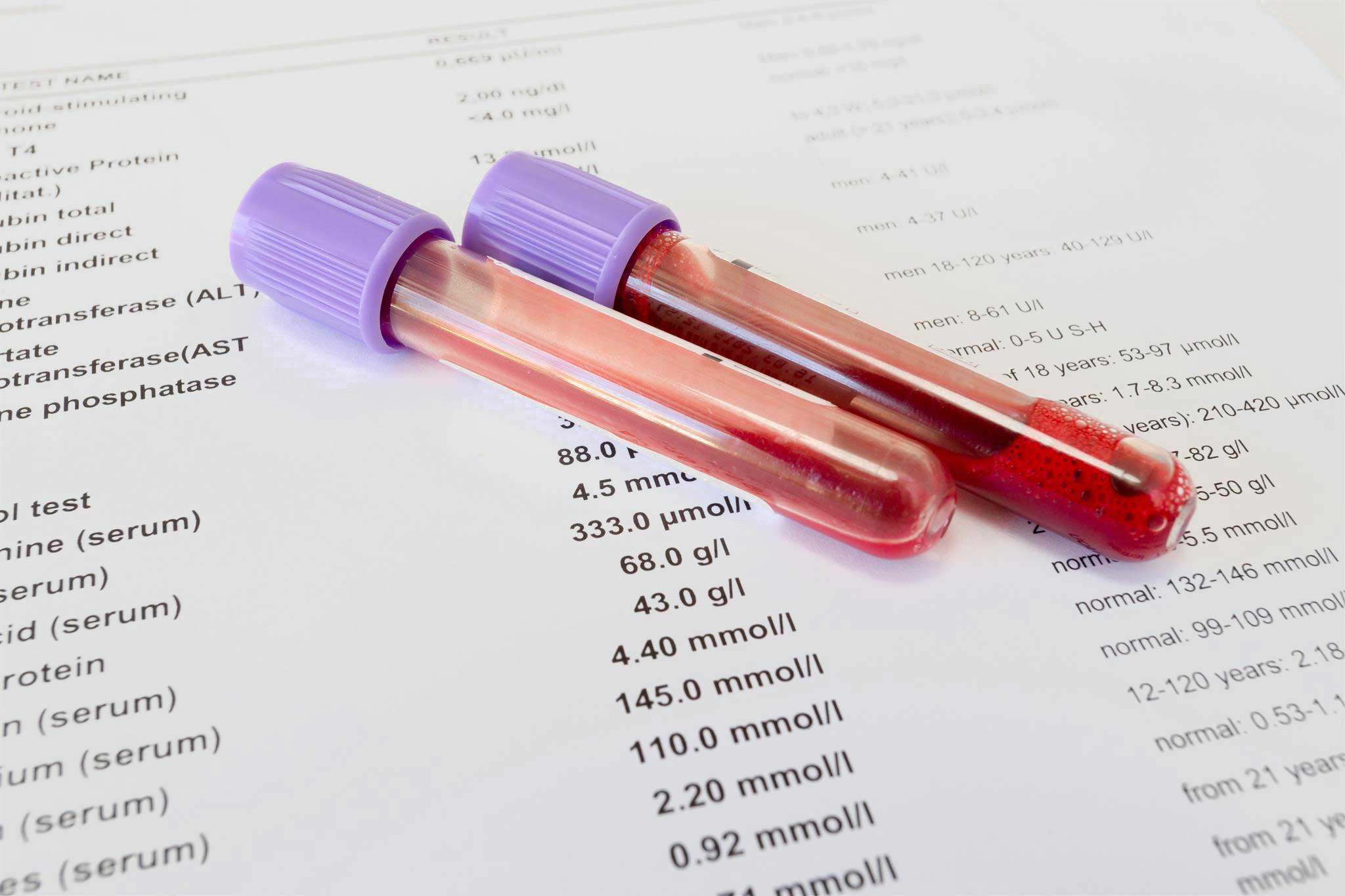Biometric Screening Blood Test Biometric Screening Blood Test